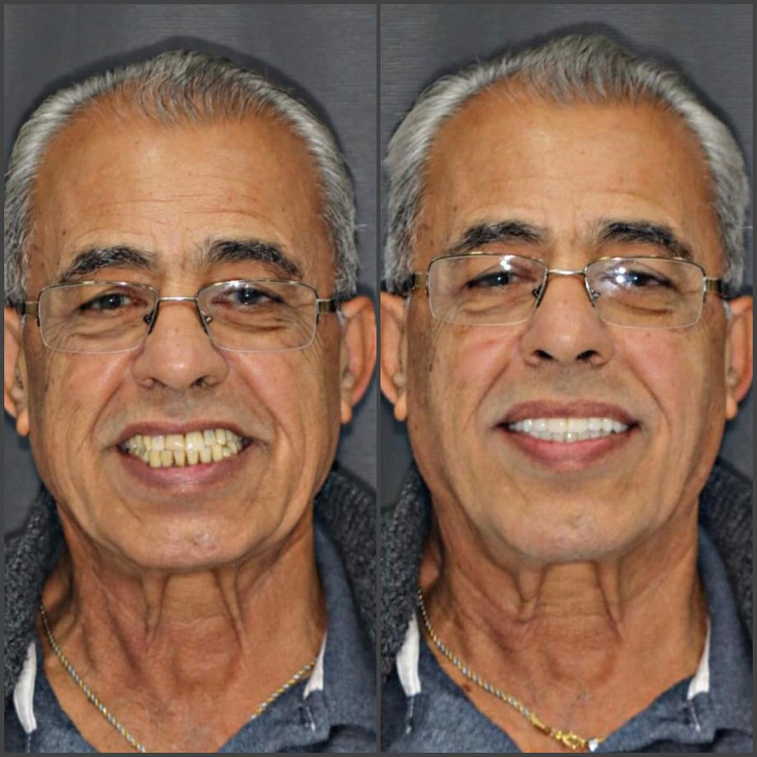 Snapinsta.app_357003667_18146896138292337_8205897141811788554_n_1080